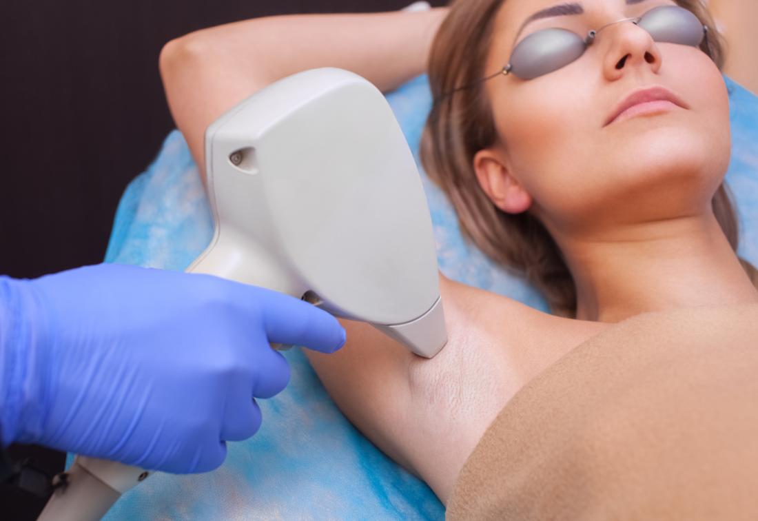 laser hair removal SERVICES